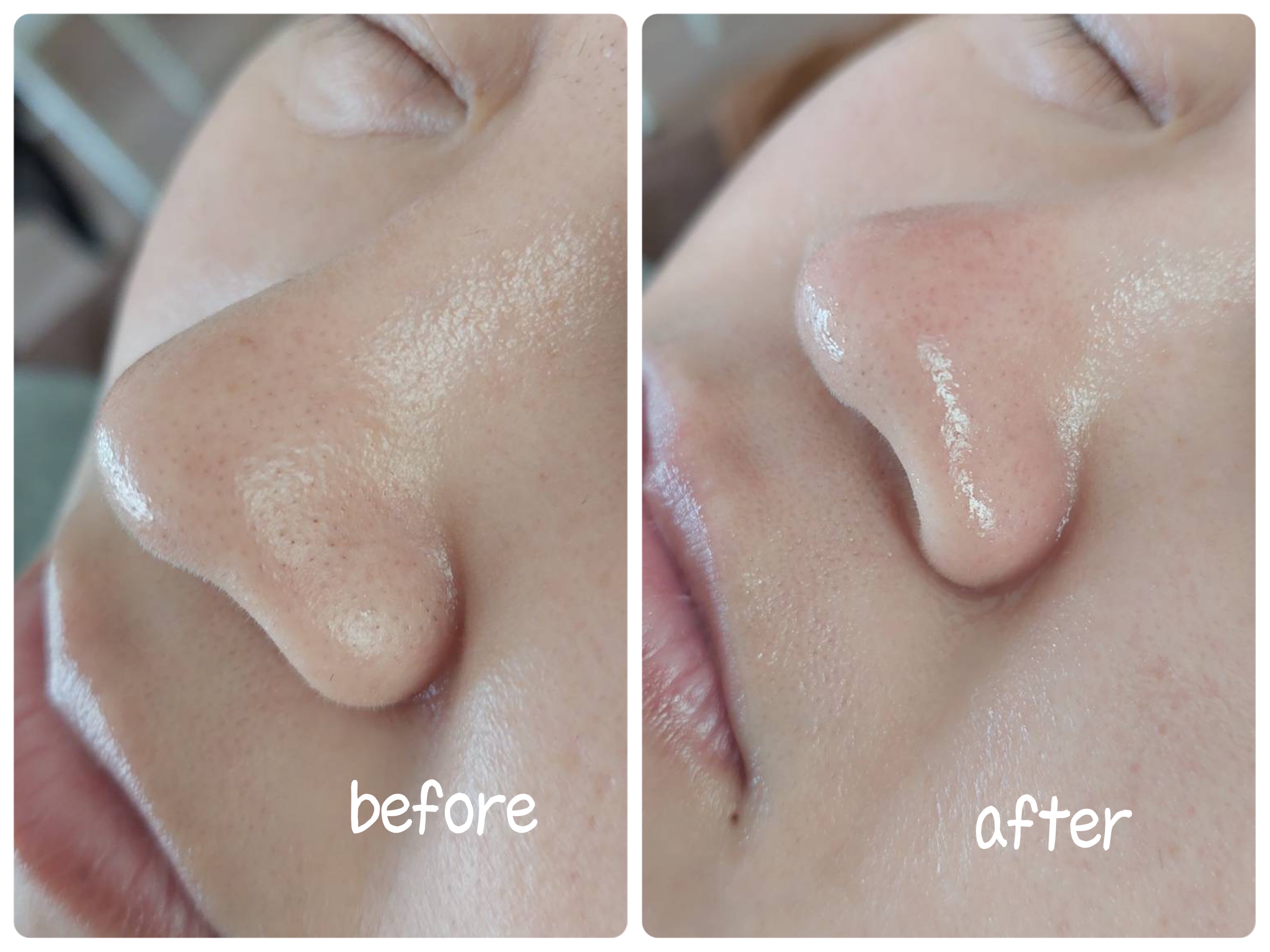 Before after