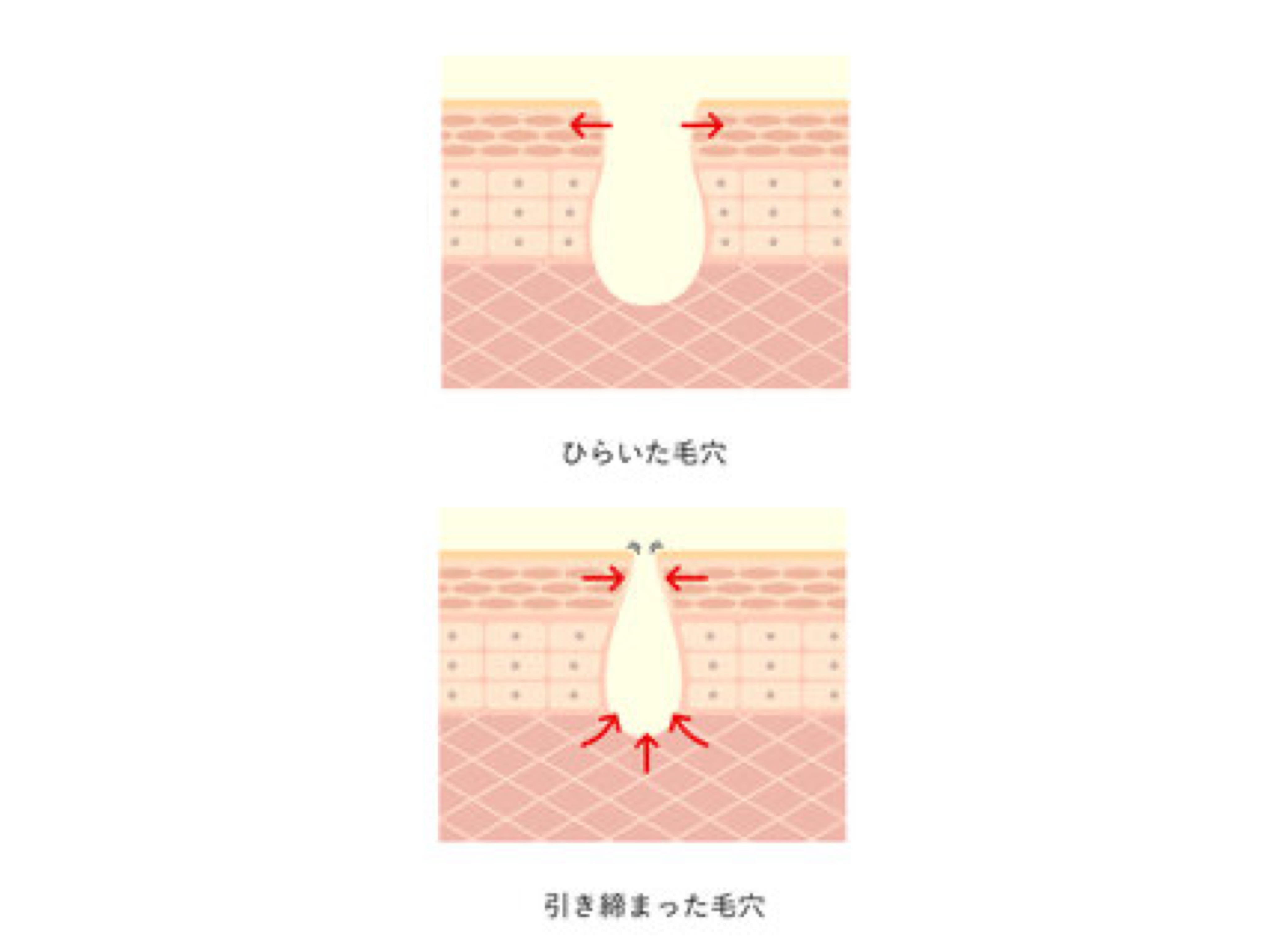 毛穴の汚れ