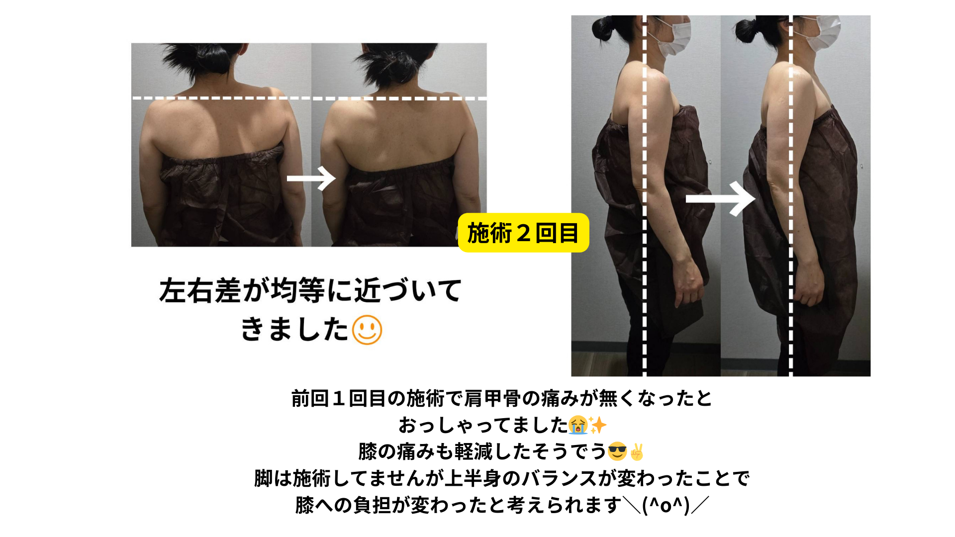 肩こり
