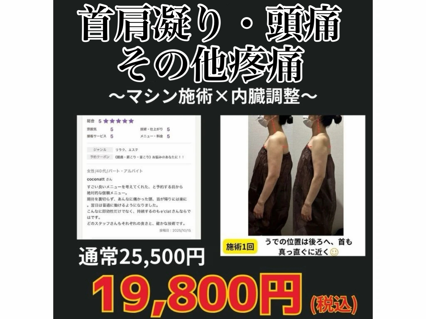 首肩凝り