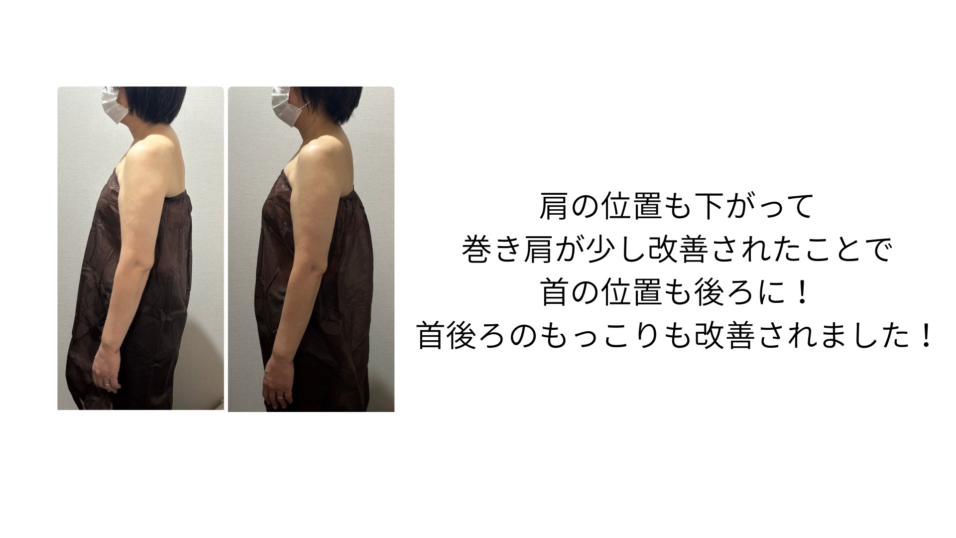 姿勢と頭痛や首肩こりはどう繋がってるの？
